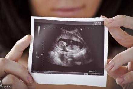 成都代孕-成都借卵生子的风险-成都如何能找代孕妈妈